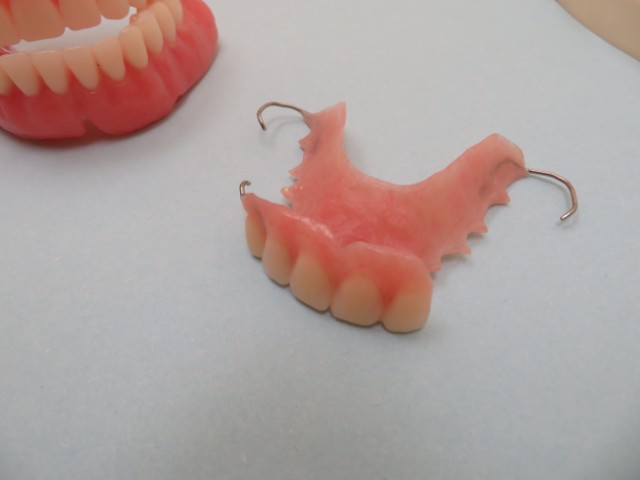 Sample of Dental Partials At Angel Dental Care