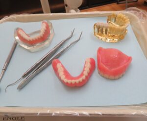 Dental Implants or Dentures? What We Tell Patients During Their El Monte Consultation