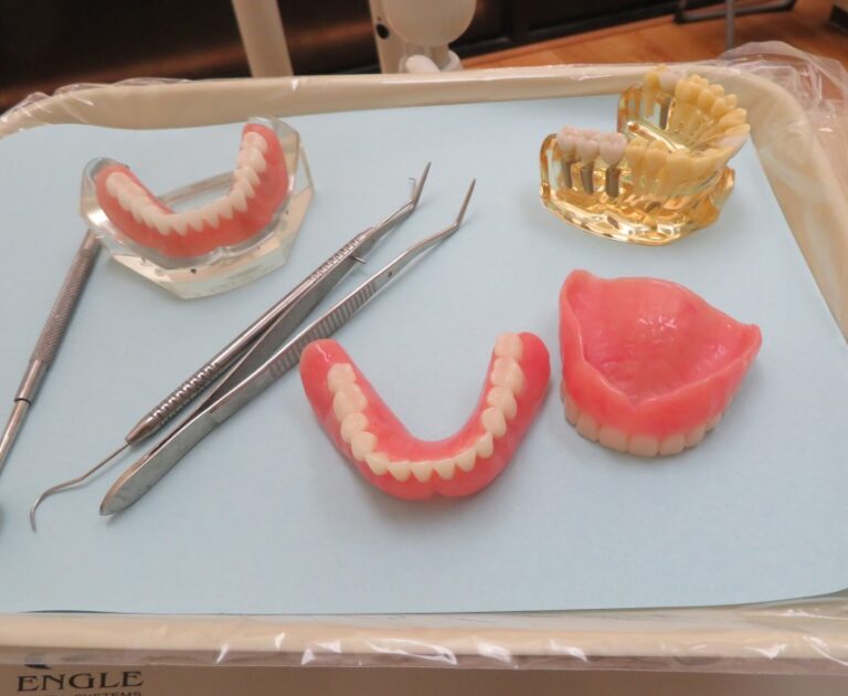 Dental Implants in El Monte