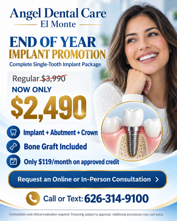 Dental Implant Special in El Monte at Angel Dental Care